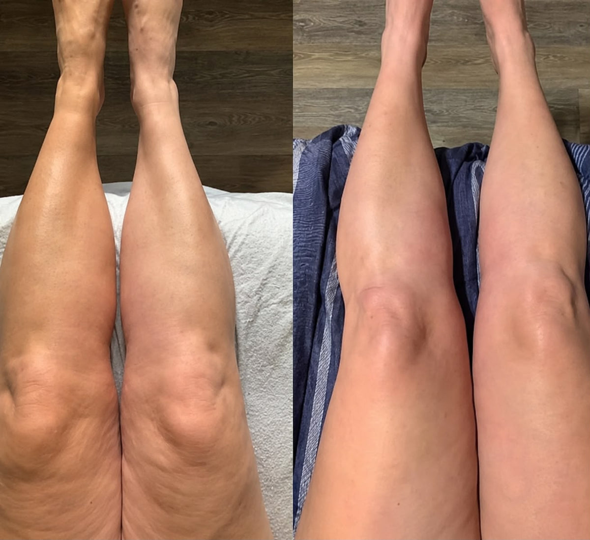 Resultado antes y después