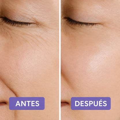 Kit Masajeador Facial Completo