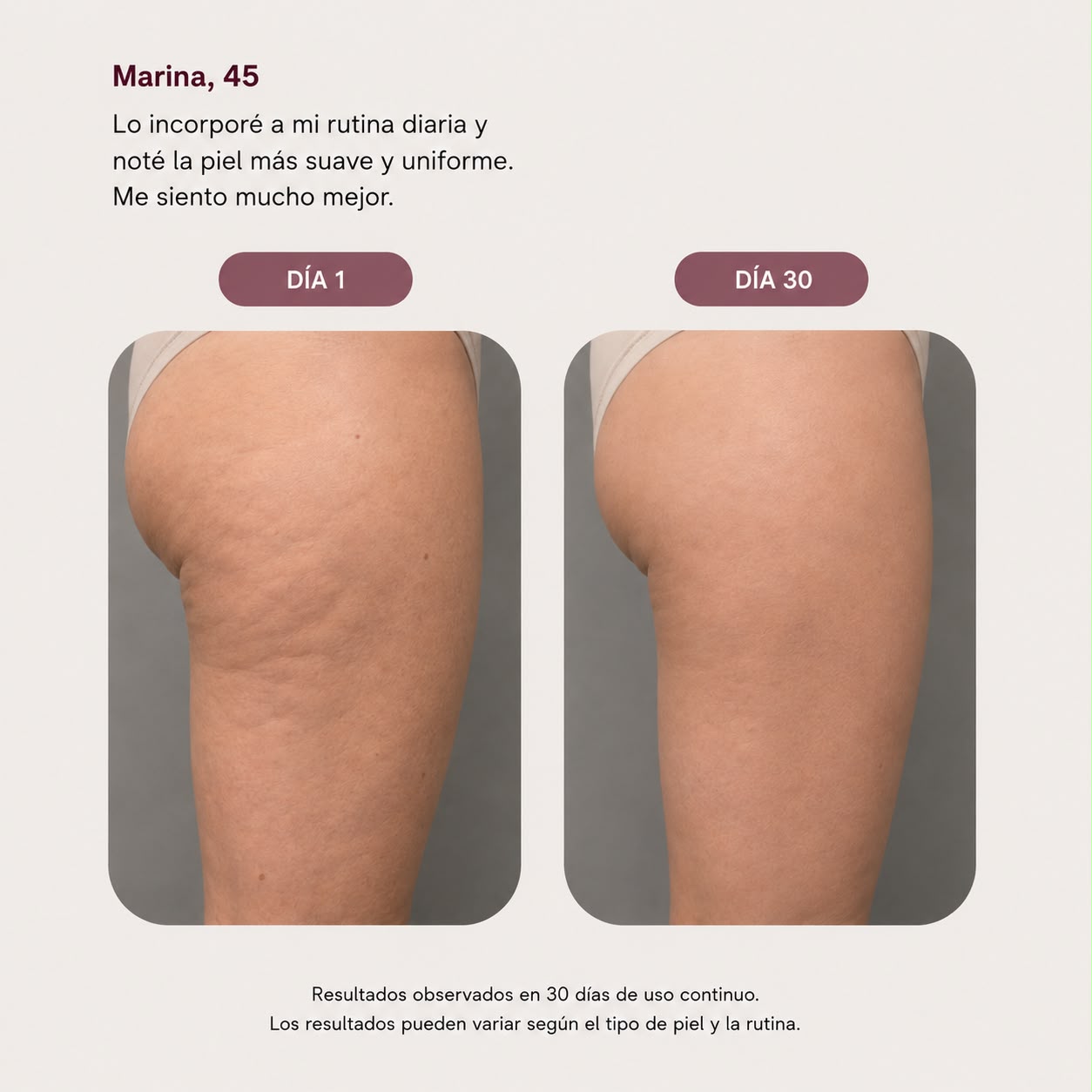 DERMODELUXE- Emulsion Corporal Anticelulitis, Antiflacidez y Efecto Drenante