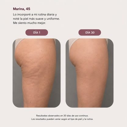 DERMODELUXE- Emulsion Corporal Anticelulitis, Antiflacidez y Efecto Drenante