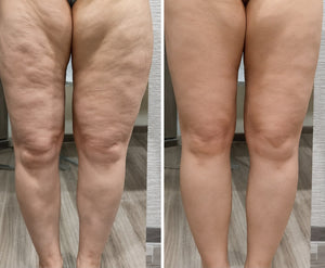 Resultado antes y después